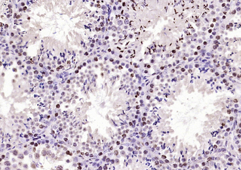 STK36 Rabbit Polyclonal Antibody
