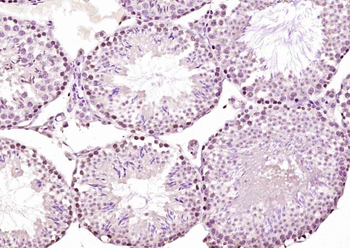 Bub1 Rabbit Polyclonal Antibody