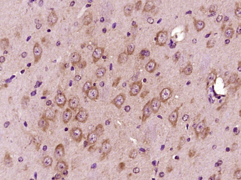 Beta-Amyloid 1-40 (CT) Rabbit Polyclonal Antibody