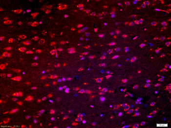 Robo Rabbit Polyclonal Antibody