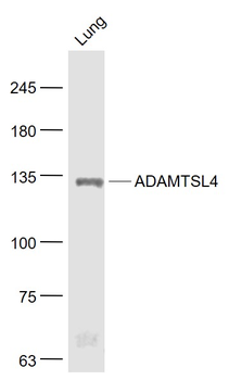 ADAMTSL4 Rabbit Polyclonal Antibody