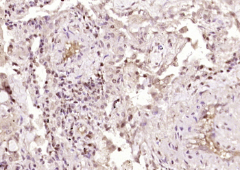 GASC1/KDM4C Rabbit Polyclonal Antibody