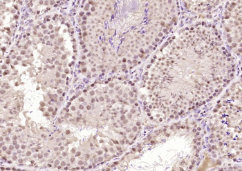 GASC1/KDM4C Rabbit Polyclonal Antibody