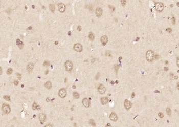 ABI2 Rabbit Polyclonal Antibody