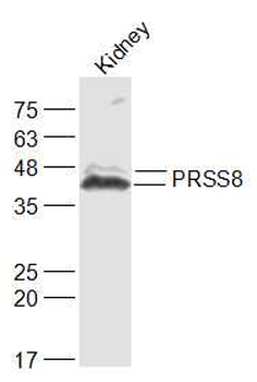PRSS8 Rabbit Polyclonal Antibody