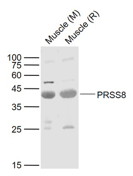 PRSS8 Rabbit Polyclonal Antibody
