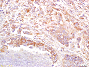 PRSS8 Rabbit Polyclonal Antibody