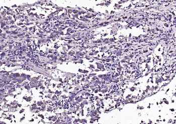 Angiopoietin-1 Rabbit Polyclonal Antibody