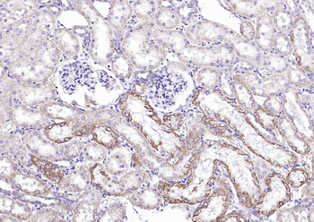 Angiopoietin-1 Rabbit Polyclonal Antibody