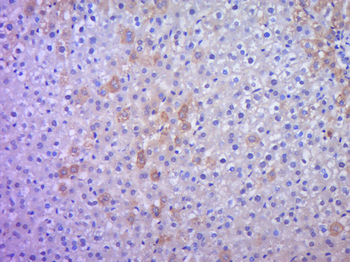 IHH Rabbit Polyclonal Antibody