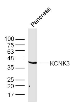 KCNK3 Rabbit Polyclonal Antibody