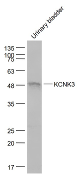 KCNK3 Rabbit Polyclonal Antibody