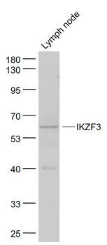 IKZF3 Rabbit Polyclonal Antibody
