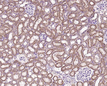 Phospho-PLB (Ser16) Rabbit Polyclonal Antibody