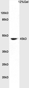 EphA7 Rabbit Polyclonal Antibody
