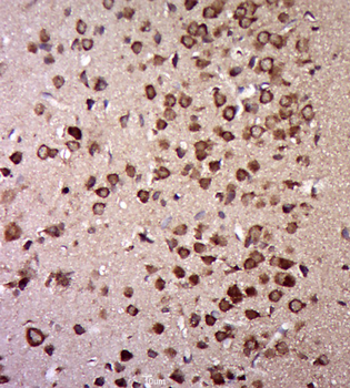 E1 Ubiquitin Activating Enzyme Rabbit Polyclonal Antibody