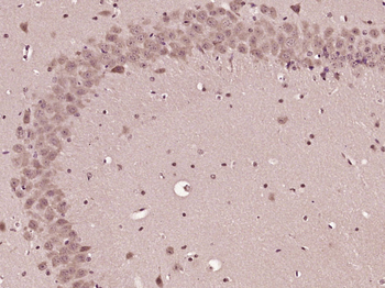 CHAC1 Rabbit Polyclonal Antibody