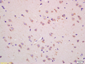 CHAC1 Rabbit Polyclonal Antibody