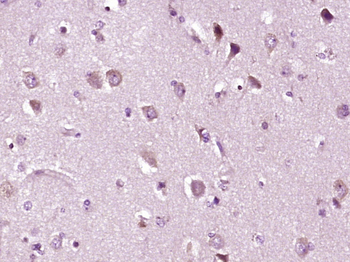 Drebrin Rabbit Polyclonal Antibody