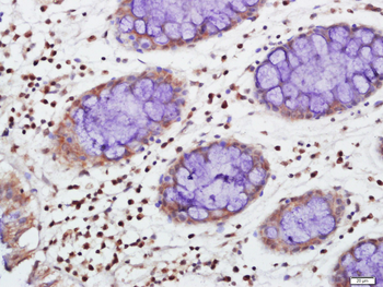 TIA1 Rabbit Polyclonal Antibody