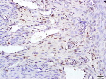 TIA1 Rabbit Polyclonal Antibody