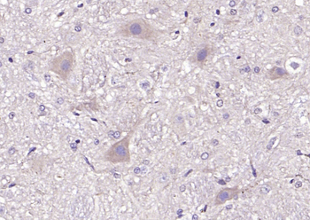 PCDH20 Rabbit Polyclonal Antibody
