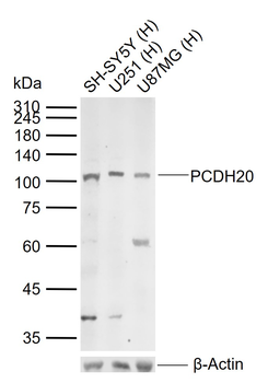 PCDH20 Rabbit Polyclonal Antibody