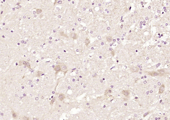 STAMBP Rabbit Polyclonal Antibody