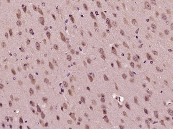 MSF/Cell division control protein septin D1 Rabbit Polyclonal Antibody