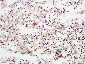 CDC45L Rabbit Polyclonal Antibody