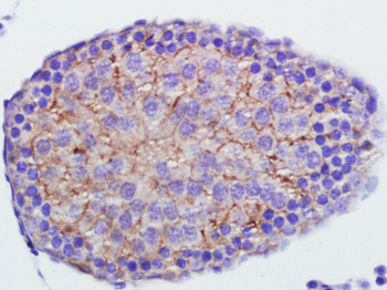 Annexin V Rabbit Polyclonal Antibody