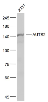 AUTS2 Rabbit Polyclonal Antibody