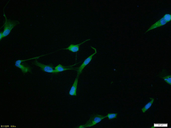 MMP2 Rabbit Polyclonal Antibody