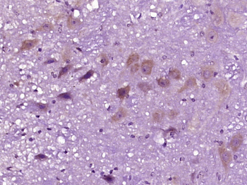 Gamma-Adaptin Rabbit Polyclonal Antibody