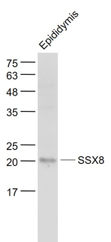SSX8 Rabbit Polyclonal Antibody
