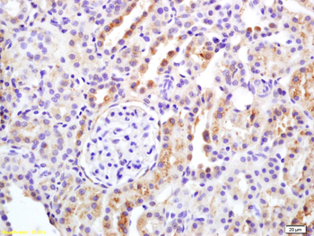 APAF1 (CT) Rabbit Polyclonal Antibody