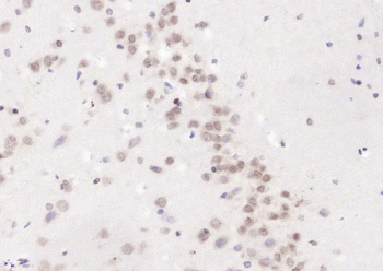 CAMTA1 Rabbit Polyclonal Antibody