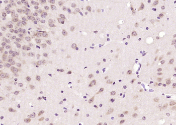 CAMTA1 Rabbit Polyclonal Antibody