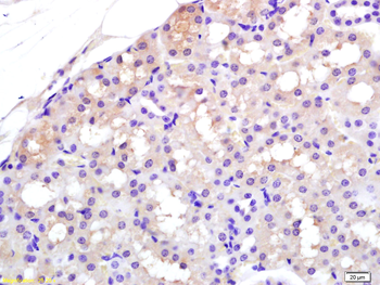APAF1 (NT) Rabbit Polyclonal Antibody