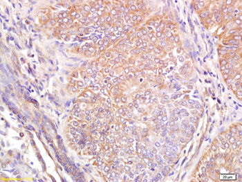 Wnt6 Rabbit Polyclonal Antibody