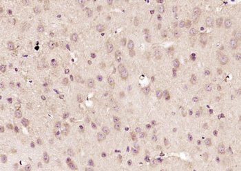 Wnt8b Rabbit Polyclonal Antibody