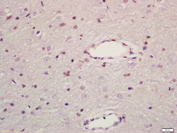 JIP1/MAPK8IP1 Rabbit Polyclonal Antibody