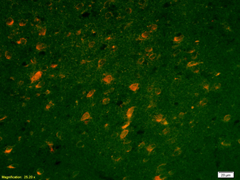 SCN10A/Nav1.8 Rabbit Polyclonal Antibody