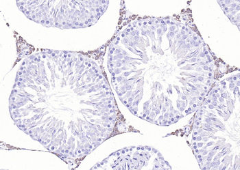 Cytochrome P450 17A1 Rabbit Polyclonal Antibody