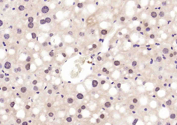 UGDH Rabbit Polyclonal Antibody