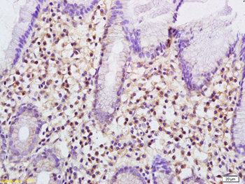 Plastin L Rabbit Polyclonal Antibody