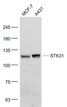 STK31 Rabbit Polyclonal Antibody
