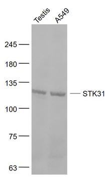 STK31 Rabbit Polyclonal Antibody