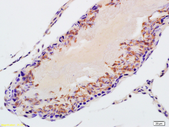 STK31 Rabbit Polyclonal Antibody