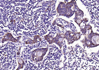 ADM2 Rabbit Polyclonal Antibody